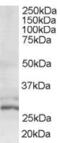Oxidoreductase HTATIP2 antibody, 46-499, ProSci, Western Blot image 