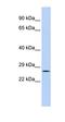 GATA Zinc Finger Domain Containing 1 antibody, orb324463, Biorbyt, Western Blot image 