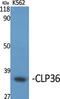 PDZ And LIM Domain 1 antibody, PA5-50937, Invitrogen Antibodies, Western Blot image 