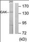 Cyclin G Associated Kinase antibody, orb178979, Biorbyt, Western Blot image 