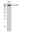 Solute Carrier Family 4 Member 8 antibody, A08194-1, Boster Biological Technology, Western Blot image 