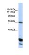 Acyl-CoA Thioesterase 11 antibody, orb77408, Biorbyt, Western Blot image 
