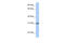 Chromosome 7 Open Reading Frame 61 antibody, 26-861, ProSci, Enzyme Linked Immunosorbent Assay image 