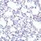 Surfactant Protein C antibody, GTX54694, GeneTex, Immunohistochemistry paraffin image 