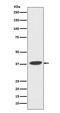 DNA Polymerase Beta antibody, M01946, Boster Biological Technology, Western Blot image 