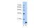 N-alpha-acetyltransferase 50, NatE catalytic subunit antibody, 30-474, ProSci, Western Blot image 