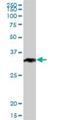 STIP1 Homology And U-Box Containing Protein 1 antibody, H00010273-B01P, Novus Biologicals, Western Blot image 