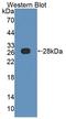 Actin Filament Associated Protein 1 antibody, LS-C725355, Lifespan Biosciences, Western Blot image 