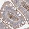 HAD antibody, NBP1-85892, Novus Biologicals, Immunohistochemistry paraffin image 