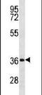 Dickkopf WNT Signaling Pathway Inhibitor 2 antibody, PA5-11616, Invitrogen Antibodies, Western Blot image 