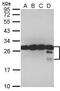 Tumor protein D52 antibody, PA5-30261, Invitrogen Antibodies, Western Blot image 