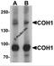 Vacuolar Protein Sorting 13 Homolog B antibody, 6931, ProSci, Western Blot image 