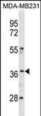 Homeobox C10 antibody, PA5-35236, Invitrogen Antibodies, Western Blot image 