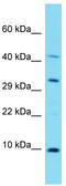 NADH:Ubiquinone Oxidoreductase Complex Assembly Factor 8 antibody, TA334846, Origene, Western Blot image 