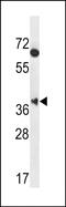 Muscleblind-like protein 2 antibody, PA5-71773, Invitrogen Antibodies, Western Blot image 