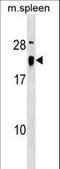 ALG13 UDP-N-Acetylglucosaminyltransferase Subunit antibody, LS-C161038, Lifespan Biosciences, Western Blot image 