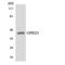 Opioid Receptor Delta 1 antibody, LS-C200299, Lifespan Biosciences, Western Blot image 