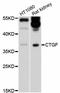 Cellular Communication Network Factor 2 antibody, abx125726, Abbexa, Western Blot image 