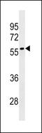 Leucine Rich Repeat Containing 69 antibody, LS-C158076, Lifespan Biosciences, Western Blot image 