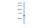 Tetratricopeptide Repeat Domain 33 antibody, 26-942, ProSci, Western Blot image 