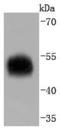 Alpha-1-antitrypsin antibody, A00720-1, Boster Biological Technology, Western Blot image 