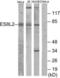 EPS8 Like 2 antibody, LS-B10002, Lifespan Biosciences, Western Blot image 