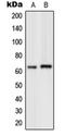G Protein-Coupled Receptor Kinase 7 antibody, orb215368, Biorbyt, Western Blot image 