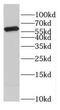 Coenzyme A Synthase antibody, FNab01823, FineTest, Western Blot image 