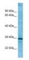 SLAM family member 5 antibody, NBP1-98410, Novus Biologicals, Western Blot image 