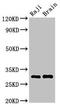 Major Histocompatibility Complex, Class II, DR Beta 3 antibody, LS-C673266, Lifespan Biosciences, Western Blot image 