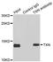 Thioredoxin antibody, STJ29953, St John