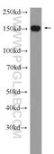 DExH-Box Helicase 57 antibody, 24525-1-AP, Proteintech Group, Western Blot image 