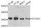 General Transcription Factor IIH Subunit 3 antibody, A11742, Boster Biological Technology, Western Blot image 