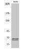 BLNK antibody, STJ91859, St John