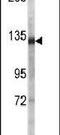 Desmoglein 2 antibody, PA5-14904, Invitrogen Antibodies, Western Blot image 