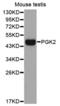 Phosphoglycerate Kinase 2 antibody, abx002947, Abbexa, Western Blot image 
