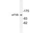 Eukaryotic Translation Initiation Factor 5B antibody, LS-C177374, Lifespan Biosciences, Western Blot image 