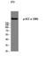 Acetyl-CoA Carboxylase Alpha antibody, STJ90780, St John