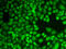 Cathepsin D antibody, LS-C331569, Lifespan Biosciences, Immunofluorescence image 