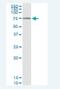 La Ribonucleoprotein Domain Family Member 6 antibody, H00055323-D01, Novus Biologicals, Immunoprecipitation image 