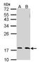 Ubiquitin Conjugating Enzyme E2 N antibody, PA5-29687, Invitrogen Antibodies, Western Blot image 