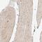 Syncoilin, Intermediate Filament Protein antibody, NBP2-14497, Novus Biologicals, Immunohistochemistry paraffin image 