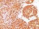 CD45RB antibody, V2410IHC-7ML, NSJ Bioreagents, Immunohistochemistry paraffin image 