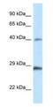 Homeobox B9 antibody, NBP1-82370, Novus Biologicals, Western Blot image 