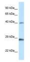Homeobox B9 antibody, NBP1-82370, Novus Biologicals, Western Blot image 