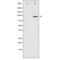 Progesterone Receptor antibody, SPC-1310D-A390, StressMarq, Western Blot image 