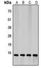 Eukaryotic Translation Initiation Factor 4E Binding Protein 1 antibody, LS-C356013, Lifespan Biosciences, Western Blot image 