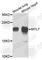 Myosin Light Chain 7 antibody, A4905, ABclonal Technology, Western Blot image 