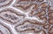 Nuclear Receptor Subfamily 3 Group C Member 1 antibody, GTX634647, GeneTex, Immunohistochemistry paraffin image 