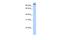 MICAL Like 1 antibody, A09767, Boster Biological Technology, Western Blot image 